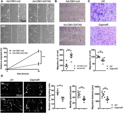 Transcription factor GATA6 promotes migration of human coronary artery smooth muscle cells in vitro